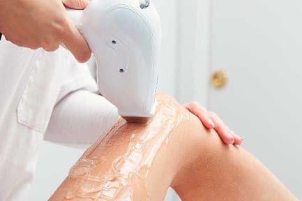 Epilation au laser